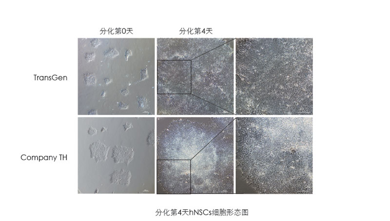 喜訊：全式金獲一項發(fā)明專利授權--“一種用于人神經(jīng)系統(tǒng)細胞培養(yǎng)和人多能性干細胞向神經(jīng)系統(tǒng)細胞分化的營養(yǎng)添加劑”