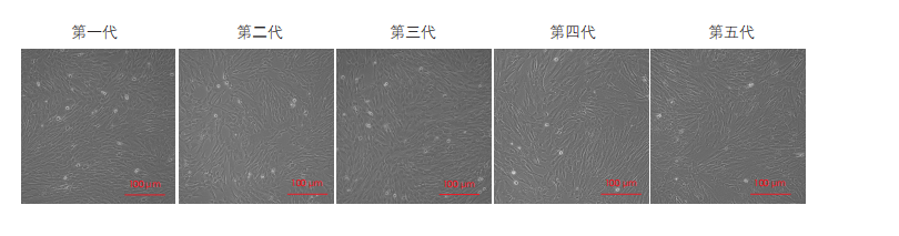 間充質(zhì)干細胞培養(yǎng)圖